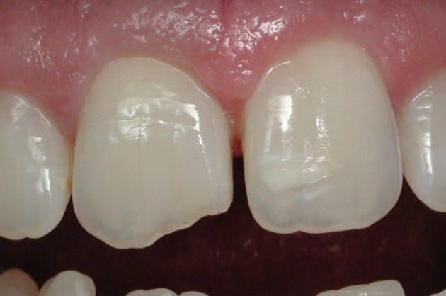 Before